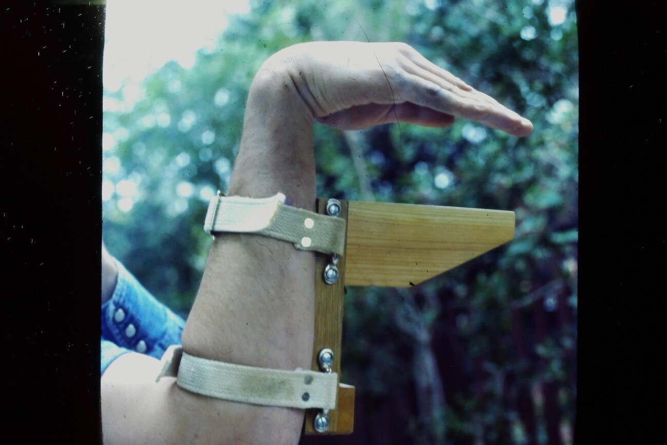 bent arm